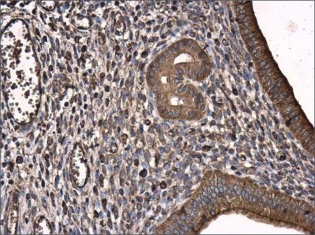 Monoclonal Anti-T-Plastin antibody produced in mouse