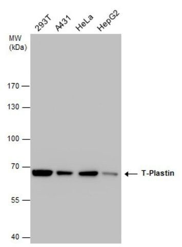 Monoclonal Anti-T-Plastin antibody produced in mouse