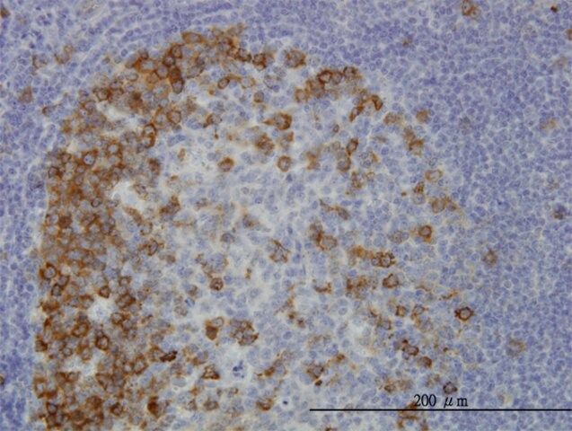 Monoclonal Anti-TACC3 antibody produced in mouse