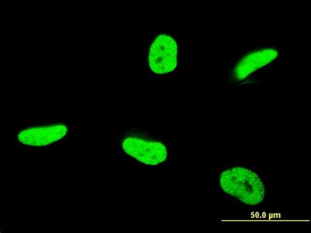 Monoclonal Anti-TAF12 antibody produced in mouse