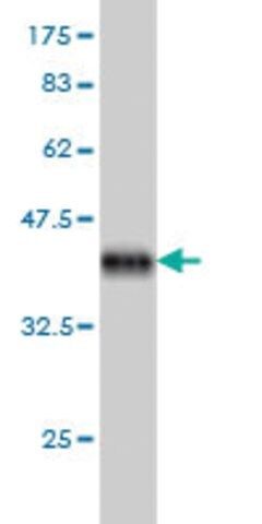 Monoclonal Anti-SYNJ1 antibody produced in mouse