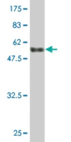 Monoclonal Anti-PMM2 antibody produced in mouse