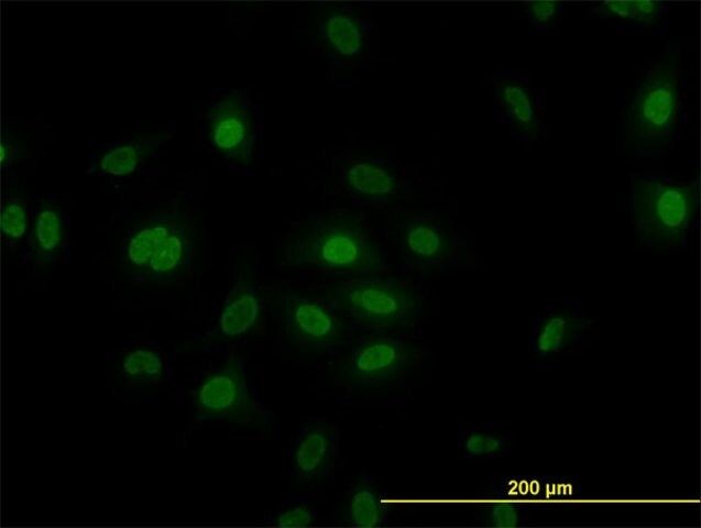 Monoclonal Anti-PLK1 antibody produced in mouse