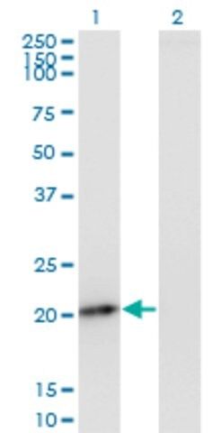 Monoclonal Anti-PMVK antibody produced in mouse