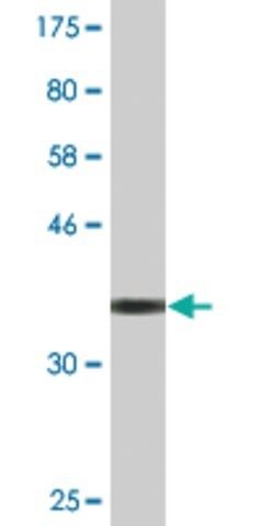 Monoclonal Anti-PLXDC2 antibody produced in mouse