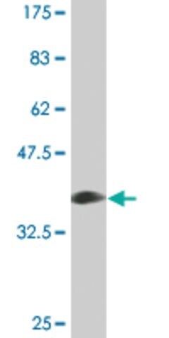 Monoclonal Anti-PLIN antibody produced in mouse