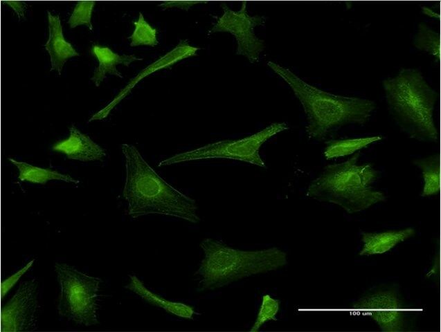 Monoclonal Anti-PLP1 antibody produced in mouse