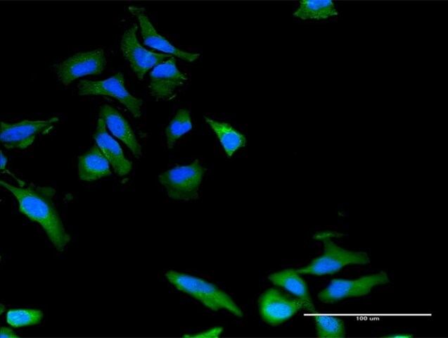 Monoclonal Anti-PLXNB2 antibody produced in mouse