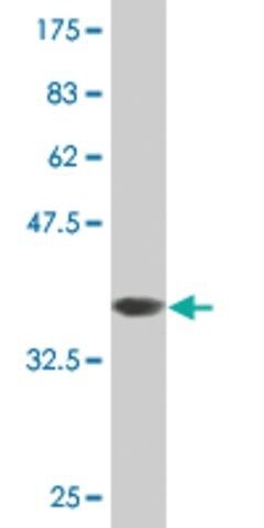 Monoclonal Anti-PLS1 antibody produced in mouse