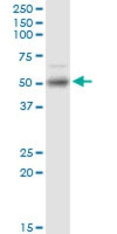 Monoclonal Anti-ETV1 antibody produced in mouse