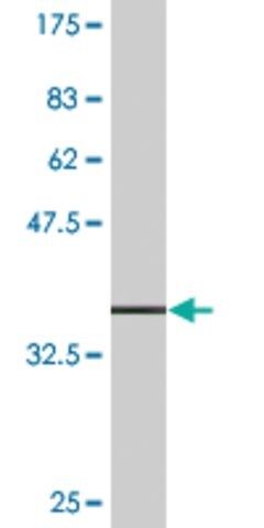 Monoclonal Anti-ETNK1 antibody produced in mouse