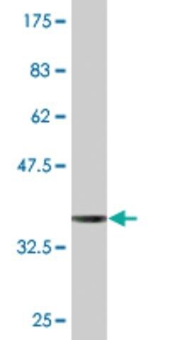 Monoclonal Anti-EVC antibody produced in mouse