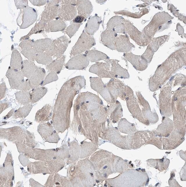 Anti-METAP2 antibody produced in rabbitͼƬ