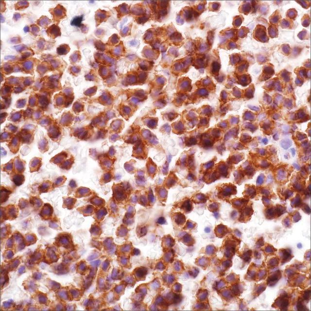 CD103 (EP206) Rabbit Monoclonal Primary Antibody