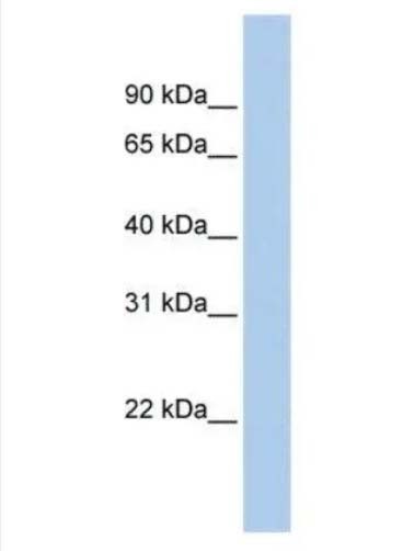 嵰39ԱA3ͼƬ