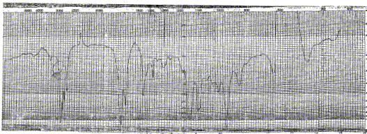 trans-2-Heptenalͼ1