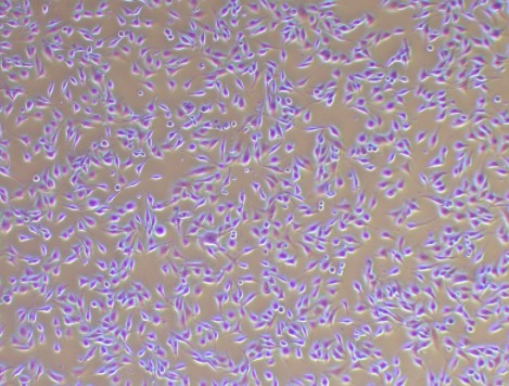 MDA-MB-231+GFPٰϸ+GFPͼƬ