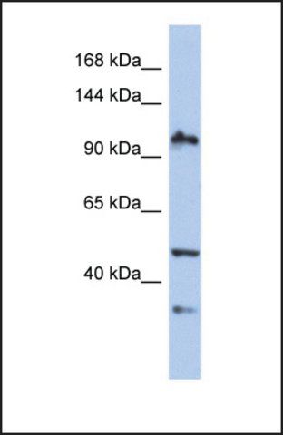 Anti-XAB2, (N-terminal) antibody produced in rabbit