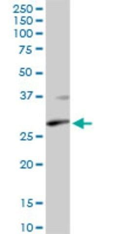 Anti-XPA antibody produced in rabbit