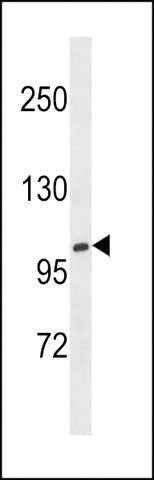 ANTI-XYLT1(N-TERMINAL) antibody produced in rabbit