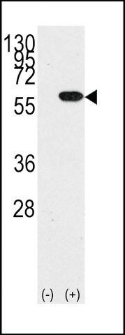 ANTI-YB1 (YBX1)(N-TERMINAL) antibody produced in rabbit