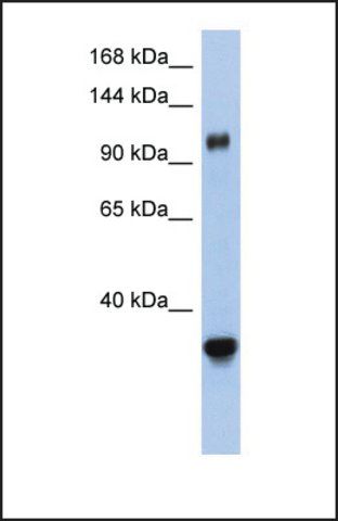 Anti-XPO5 antibody produced in rabbit