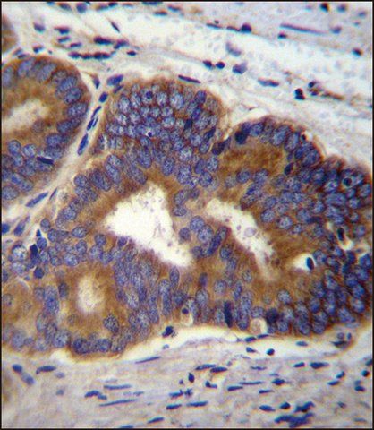 ANTI-YI016 (C-TERM) antibody produced in rabbit