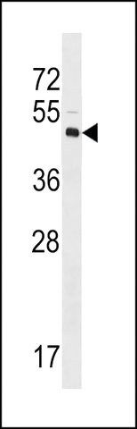 ANTI-XLKD1(N-TERMINAL) antibody produced in rabbit