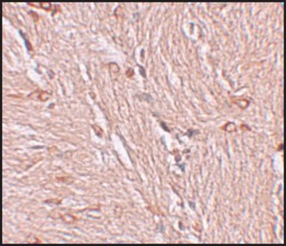 Anti-ZBTB4 antibody produced in rabbit