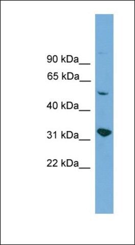 Anti-YIPF2 antibody produced in rabbit