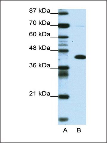 Anti-ZBTB25 antibody produced in rabbit