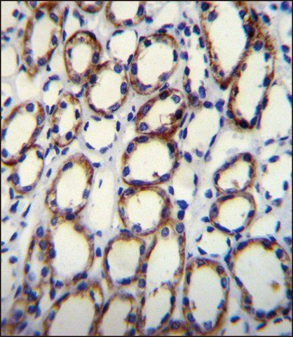 ANTI-YPEL2 (C-TERM) antibody produced in rabbit