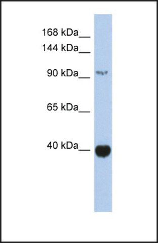 Anti-ZBTB4 antibody produced in rabbit