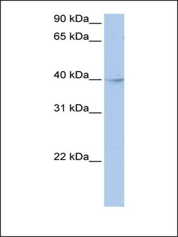 Anti-ZBTB6 (AB3) antibody produced in rabbit