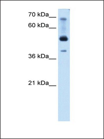 Anti-TFAP2B (AB1) antibody produced in rabbit