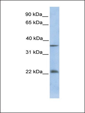 Anti-RYBP antibody produced in rabbit