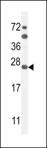 ANTI-SCN1B (N-TERM) antibody produced in rabbit