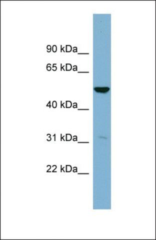 Anti-SDSL antibody produced in rabbit