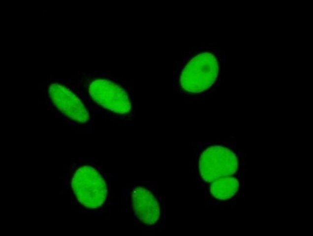 Anti-SAE1 antibody produced in mouse