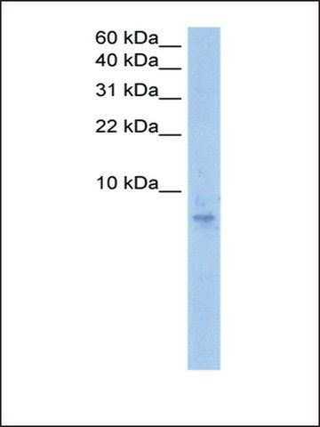 Anti-SEPT6 (AB1) antibody produced in rabbit