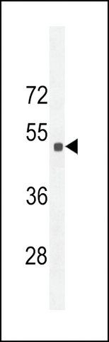 ANTI-SESTRIN-2 (CENTER) antibody produced in rabbit