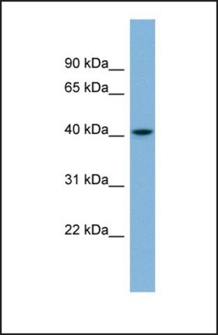 Anti-SERPINI1 antibody produced in rabbit