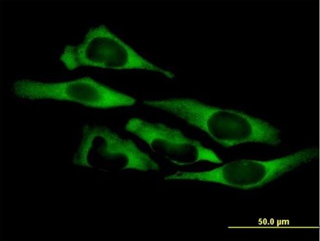 Anti-QARS antibody produced in mouse