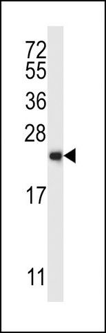 ANTI-RAB1B (C-TERM) antibody produced in rabbit