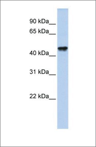 Anti-QTRTD1 antibody produced in rabbit