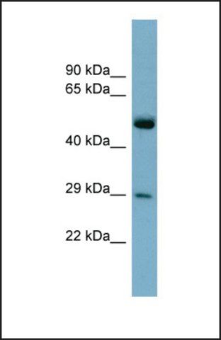 Anti-RAB27A antibody produced in rabbit