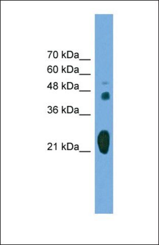 Anti-RAB37 antibody produced in rabbit