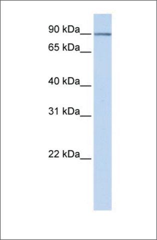 Anti-RBBP8 antibody produced in rabbit