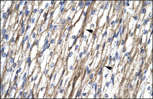 Anti-RBM10 (AB2) antibody produced in rabbit