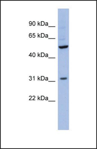 Anti-RBMS3 antibody produced in rabbit